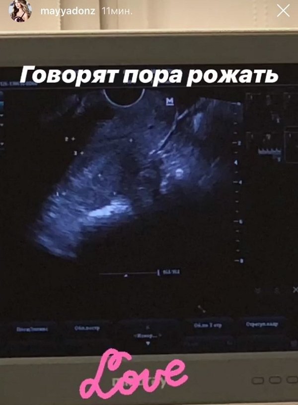 Майе Донцовой посоветовали готовиться к родам