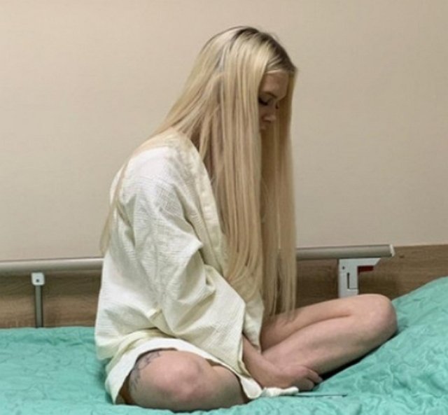 Яна Шевцова сбежала из-под ножа хирурга