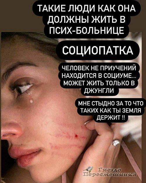 Анна Мадан: Она разорвала мне лицо