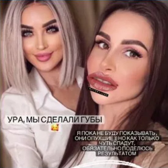 Илья Яббаров побывал на приёме у косметолога