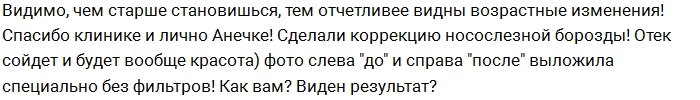 Ермакова больше не может обойтись без пластики