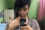 Поклонники разочарованы результатами уколов красоты Александры Черно