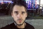 Евгений Ромашов упал с карниза и повредил ребра