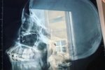 Наташа Игрунова: Заявление написано, дело за полицией