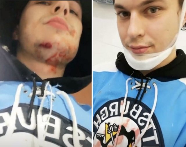 Илья Григоренко попал на операционный стол
