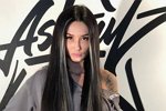 Турецкие врачи взялись за исправление носа Марины Мексики