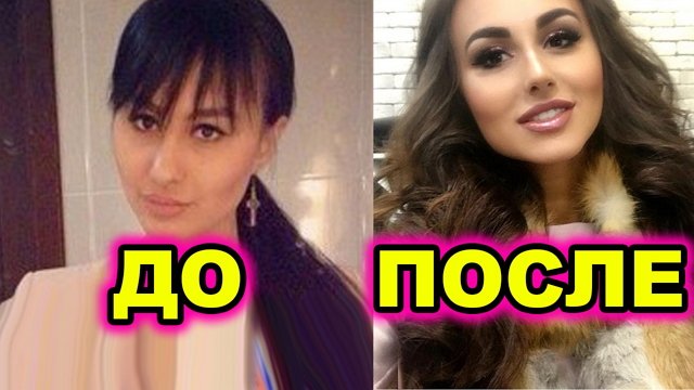 Валерия Фрост не сознаётся в том, что делала пластику