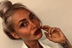 Катя Скютте шокировала подписчиков обезображенным лицом
