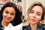 Анастасия Лисова: Мой нос всегда был разных размеров