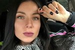 У Алеси Клочко диагностировали анемию