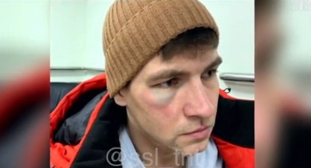 За фингал под глазом Дмитренко должен благодарить свою жену?