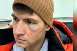 За фингал под глазом Дмитренко должен благодарить свою жену?
