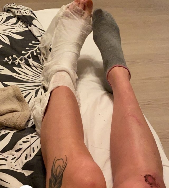 Екатерина Скютте серьезно повредила ногу