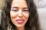 Татьяна Строкова: Мне всё делали под местным наркозом