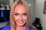 Зрители пришли в ужас от нового лица Дарьи Пынзарь