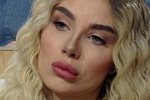 Для Паршиной важнее губы, чем отношения с Уманским?