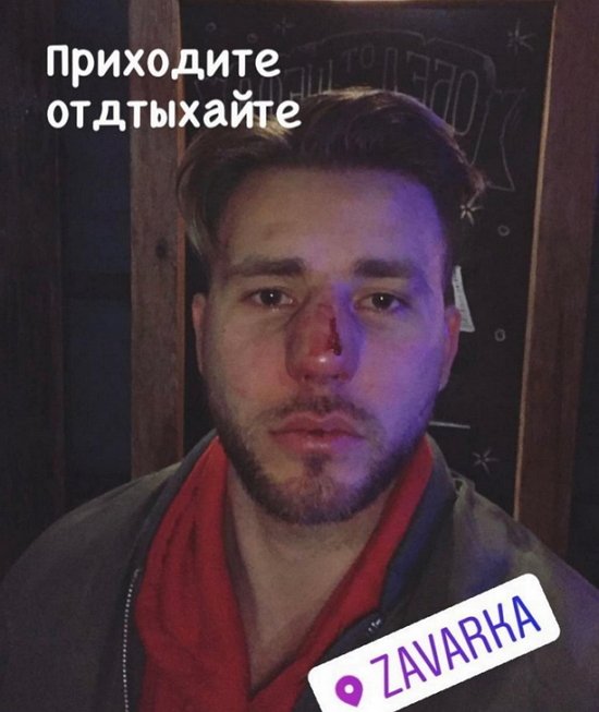 Дмитрий Чайков ввязался в драку в клубе