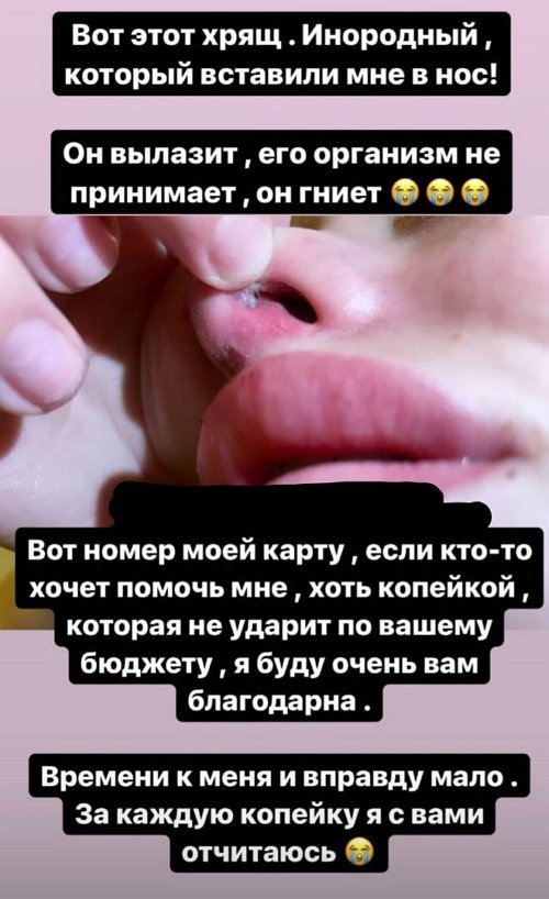 Анастасия Балинская: Это просто кошмар!