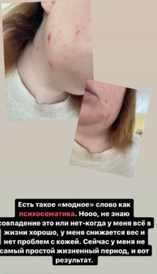 Александра Черно: Это просто психосоматика