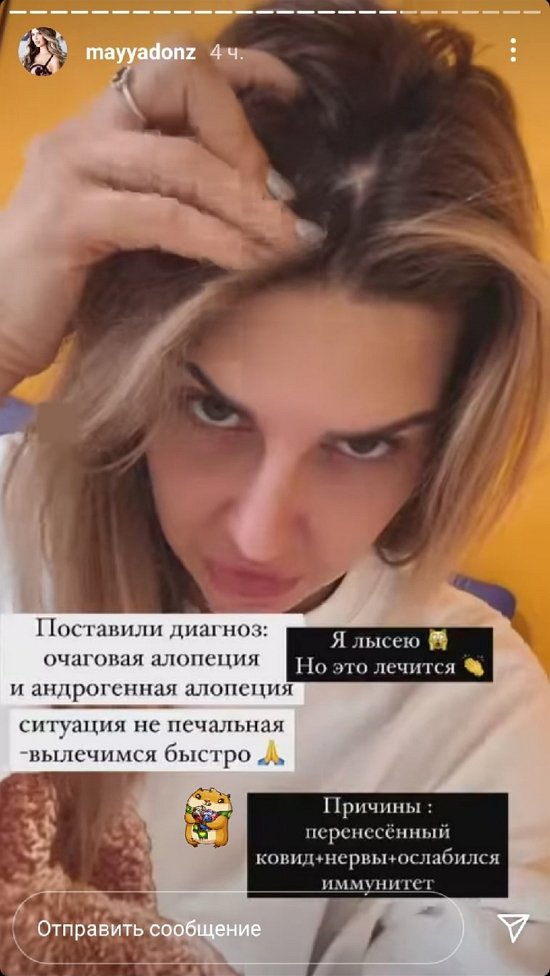 Майя Донцова: Объем волос давно пропал