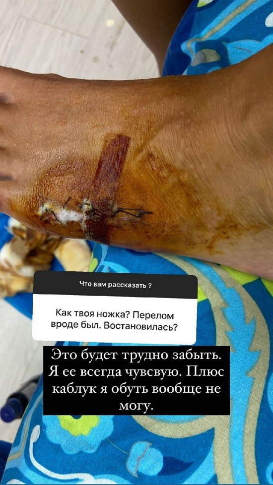 Анастасия Стецевят: В 3 года меня чуть не загрызли собаки