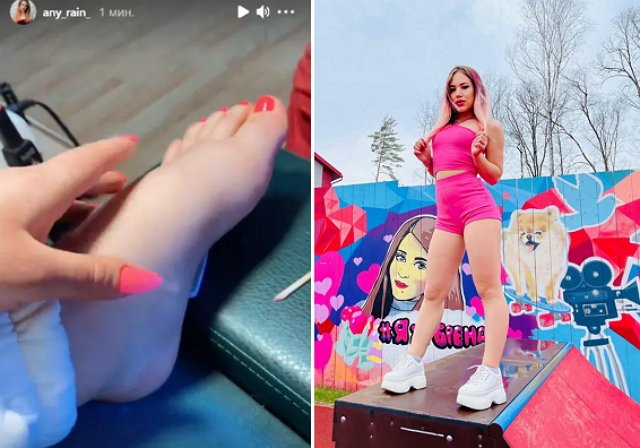 Анастасия Роинашвили пожаловалась на травму ноги