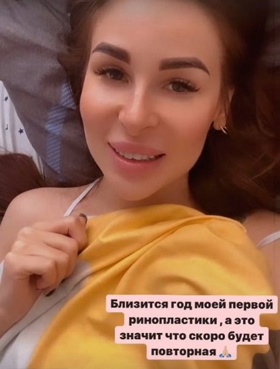 Анастасия Голд идет на повторную ринопластику