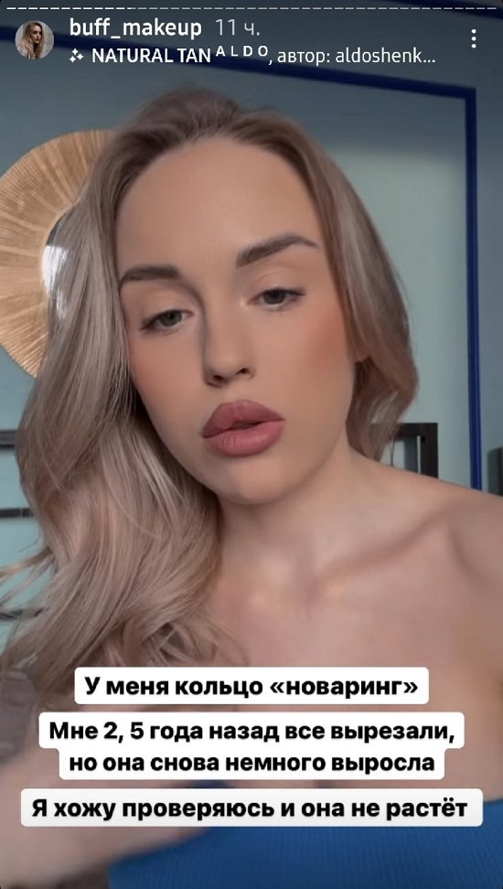 Милена Безбородова: У меня с детства были уплотнения в груди