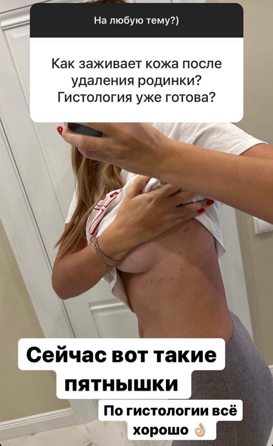 Элла Суханова: Было пару штук, но я их вырвала!