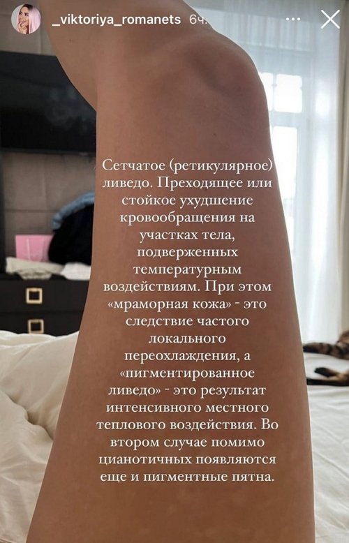 Виктория Романец: Они ещё больше становятся заметны
