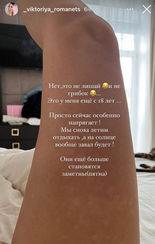Виктория Романец: Они ещё больше становятся заметны