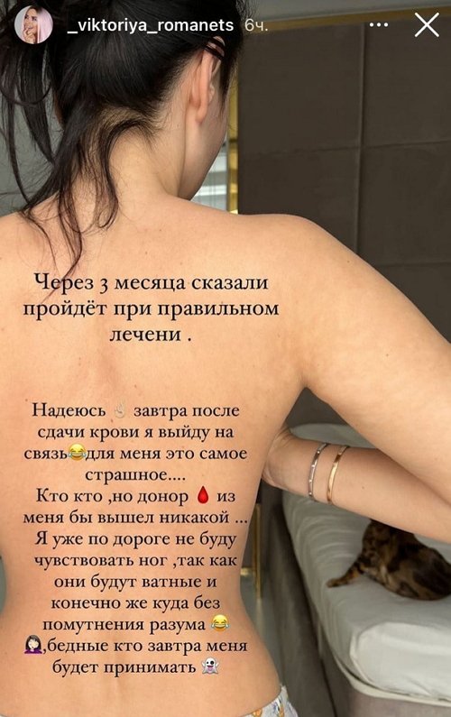 Виктория Романец: Они ещё больше становятся заметны