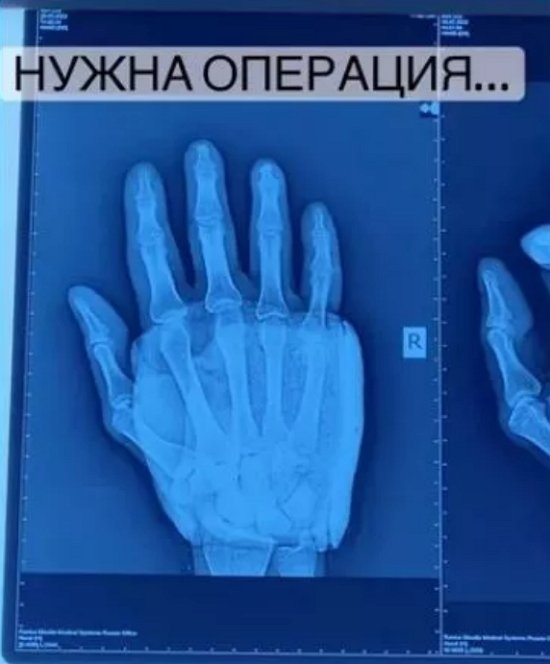 Алексей Безус недоволен платной медициной