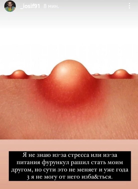 Иосиф Оганесян: Как вылечить фурункул?