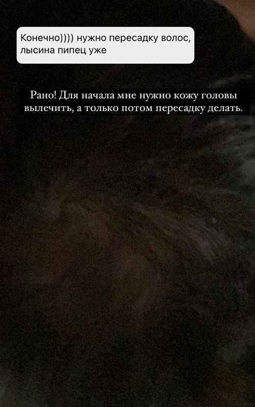 Иосиф Оганесян: Для начала нужно вылечить кожу головы