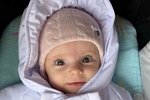 Антонина Тодерика: Главное, что это не гемангиома