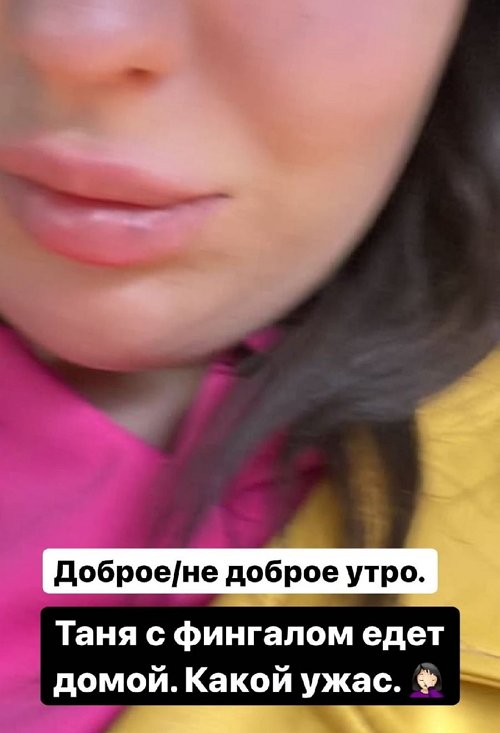 Сестра Александры Оганесян получила в глаз в драке в клубе