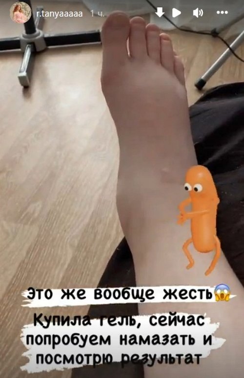 Татьяна Репина страдает от отёков ног