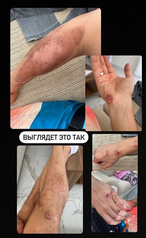Федор Стрелков обнаружился в Турции