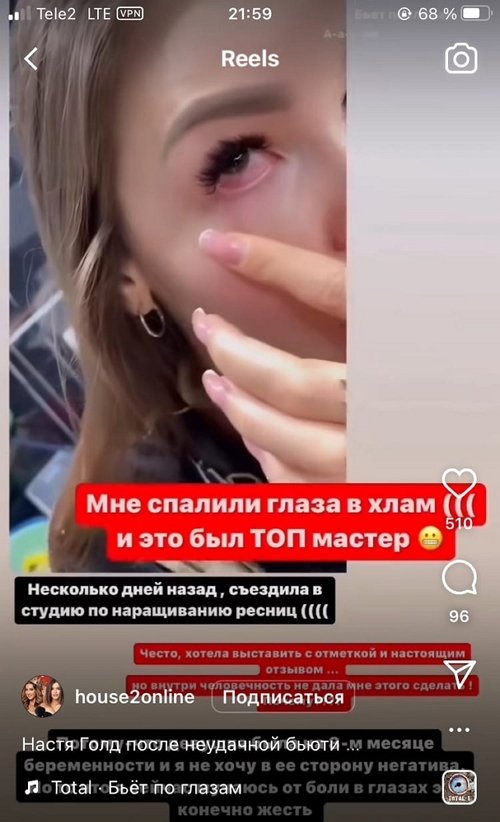 Анастасия Голд: Мучаюсь от боли в глазах