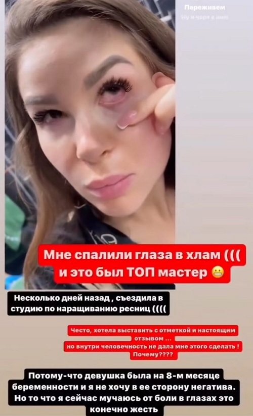 Анастасия Голд: Мучаюсь от боли в глазах