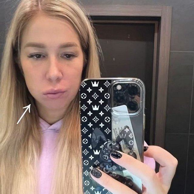 Надежда Ермакова готовится к беременности
