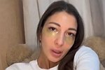 Яна Захарова: Прогноз не очень хороший