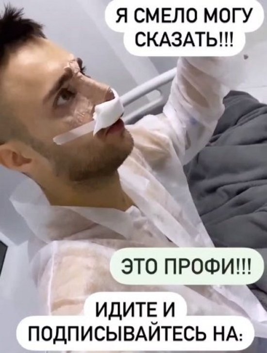 Алексей Безус сделал пластику носа