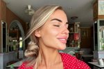Екатерина Скалон заговорила о ринопластике
