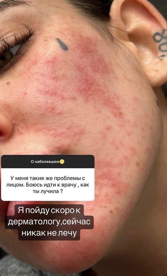 Алёна Опенченко: У меня тоже такие мысли...