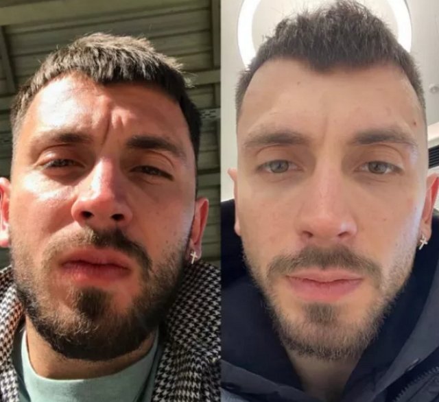 Михаил Козлов пожаловался на свой внешний вид