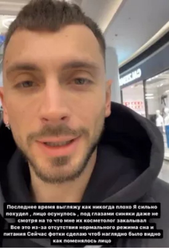 Михаил Козлов пожаловался на свой внешний вид
