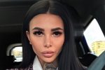Безверхова начала процесс по восстановлению природной внешности