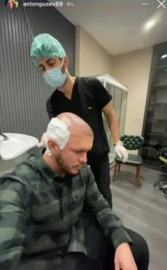 Антон Гусев поехал в Турцию, чтобы вернуть былую красоту